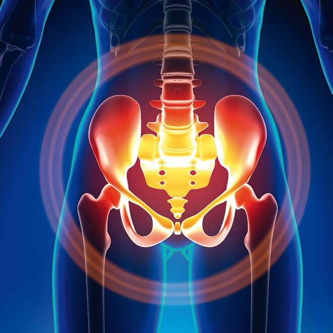 Αρθροπλαστική ισχίου